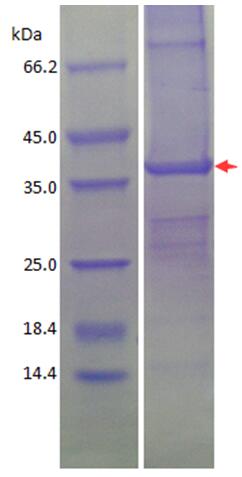 SDS-PAGE analysis of purified Escherichia coli CdtB (CBB stained).